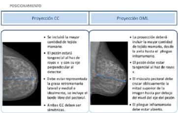 PROYECCIONES EN MASTOGRAFIA. aspectos tecnicos