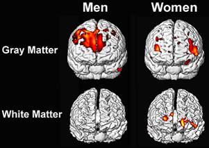 La Anatomia Masculina del Cerebro Predispone al Autismo