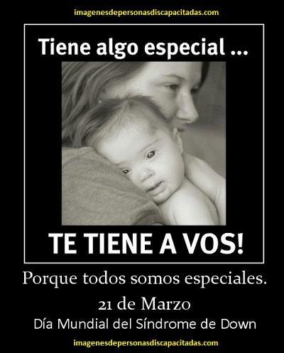 dia de los niños con sindrome down bebes