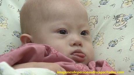 sindrome de down en bebes recien nacidos hijo