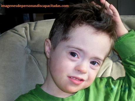 rasgos de un niño con sindrome de down fisicas