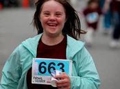 fotos personas sindrome down mira sintomas