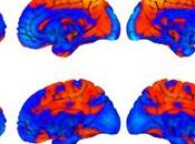 cerebros astronautas cambian forma durante vuelo espacial
