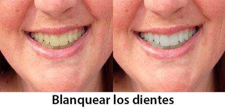 Blanquear los dientes en fotografías