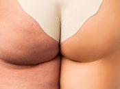 ¿Por apostar Lymphocell para estar deslumbrante boda?