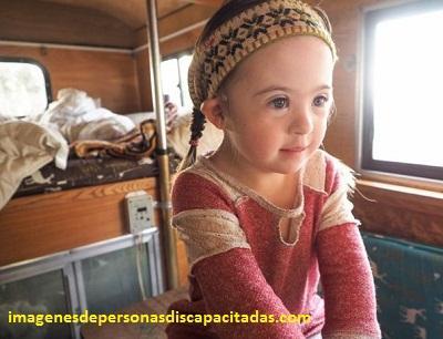 fotos de niños con sindrome down tratamiento