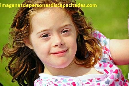 fotos de niños con sindrome down carateristicas