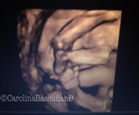 Un encuentro prematuro Un encuentro prematuro