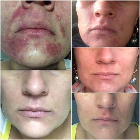 ¿Cuánto cuesta tener una piel bonita?