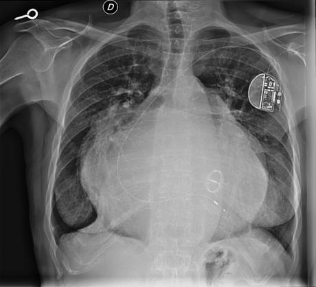 Grandeza de corazón