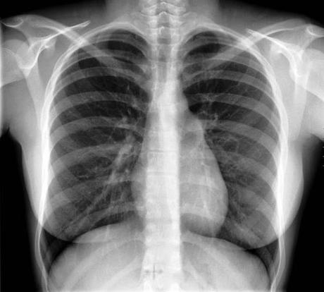 Grandeza de corazón