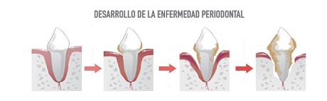 La enfermedad periodontal en gatos: 3 cosas que hay que saber