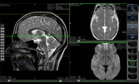 Matrix hospitalario: centro virtual donde sólo falta el paciente.