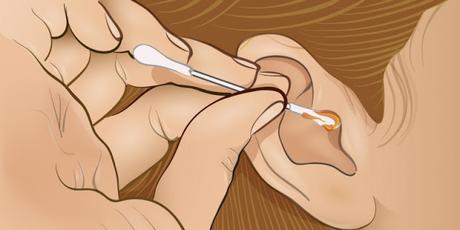 La cera de los oídos puede decir mucho sobre tu salud