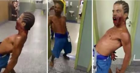 Un “poseído por el diablo” con la cara ensangrentada aterroriza un hospital en #Brasil #Terror #Religiones (VIDEO)