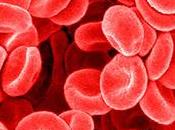 Coagulación intravascular diseminada (CID)