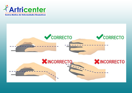 El cuidado de las articulaciones de la mano