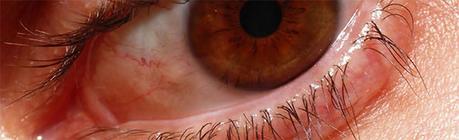 Retinopatía diabética