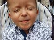 Parálisis cerebral negligencia. #TaponesParaDavid solidaridad.