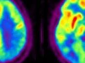 móviles pueden alterar actividad cerebral