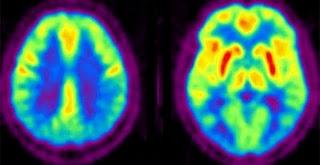 Los móviles pueden alterar la actividad cerebral