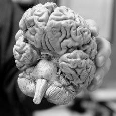 Donar el cuerpo a la ciencia