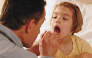 Los antibióticos causan anginas de repetición