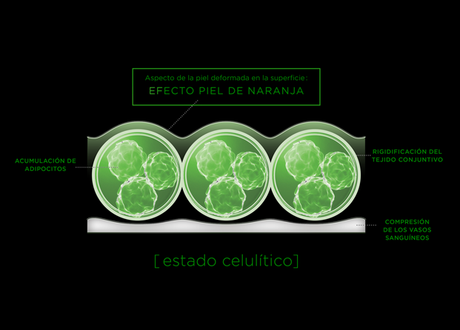 El reto Elancyl: probamos Slim Design, uno de los mejores anticelulíticos de Farmacia