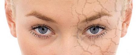 Aceites esenciales para piel seca