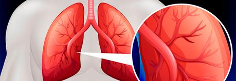 Hipertensión pulmonar