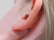 Mastoiditis