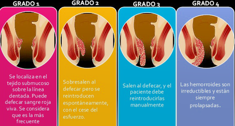 4 enfermedades del aparato digestivo