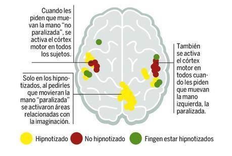 Hipnosis clínica. ¿Es eficaz o una engañifa?