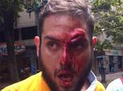 Colectivos hieren diputado opositor Juan Requesens #Venezuela (FOTO)