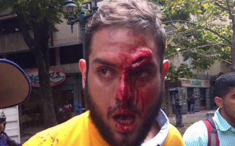 Colectivos hieren al diputado opositor Juan Requesens #Venezuela (FOTO)