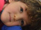 Alteración cromosoma 17-p13. historia Izan, caso número