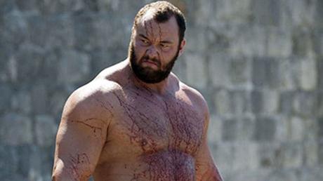 Esta estrella de Juego de Tronos #GoT padece una extraña enfermedad