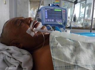 Caso de negligencia médica en anestesia Nº 1: ¿