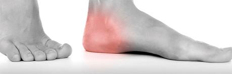 Tratamiento del espolón calcáneo