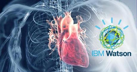 IBM presenta solución Watson Health para imagenología cognitiva.