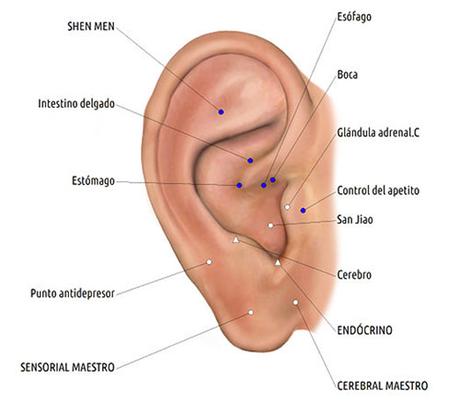 Acupuntura para control del peso