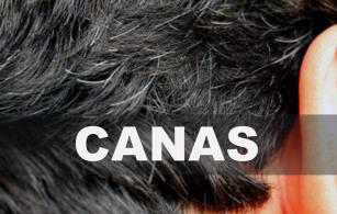 Científicos descubren relación de las canas con el riesgo de enfermedades cardiovasculares en los hombres