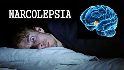 Narcolepsia