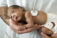 Caso de negligencia médica en anestesia Nº 6: Muerte por anestesia mal administrada en gestante Caso de negligencia médica en anestesia Nº 6: Muerte por anestesia mal administrada en gestante