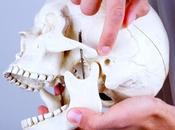 Síndrome articulación temporomandibular