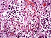 ¿Qué Calicivirus Felino? Conoce Todo Sobre Este Virus Común Peligroso Para Gato.