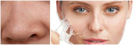 Eliminar los puntos negros con tratamientos caseros