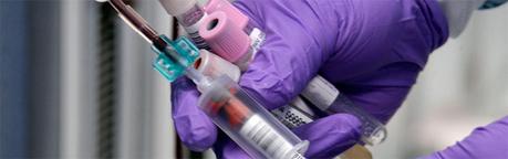 Eosinófilos altos en el análisis de sangre