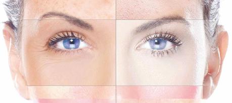 Tratamientos antimanchas