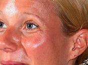 Como evitar brillos exceso sebo rostro